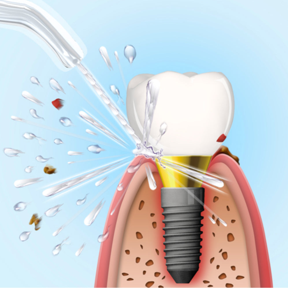 Aquapick AQ-350 Water Flosser - Advanced Oral Irrigation System